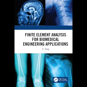  Finite Element Analysis for Biomedical Engineering Application
