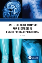  Finite Element Analysis for Biomedical Engineering Application